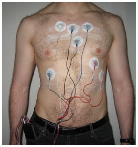 holter-monitor